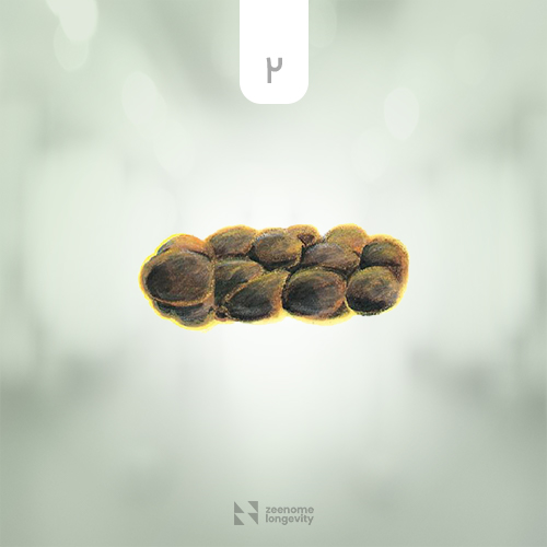 نمونه مدفوع ناسالم، یبوست متوسط