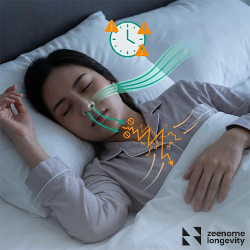 آپنه خواب مختل کننده مراحل خواب
